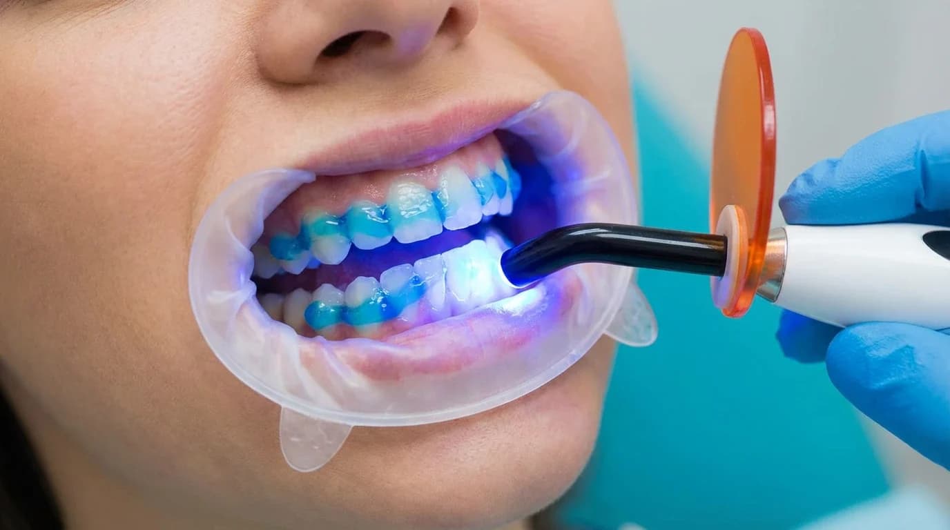 Patient smiling confidently after implant-supported dental bridge